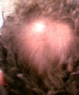 Se nos est&aacute; cayendo el pelo